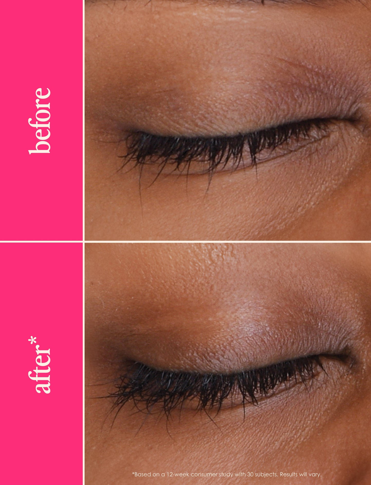 GrandeLASH-MD Lash Enhancing Serum: 1 mL (6 Week Supply)
