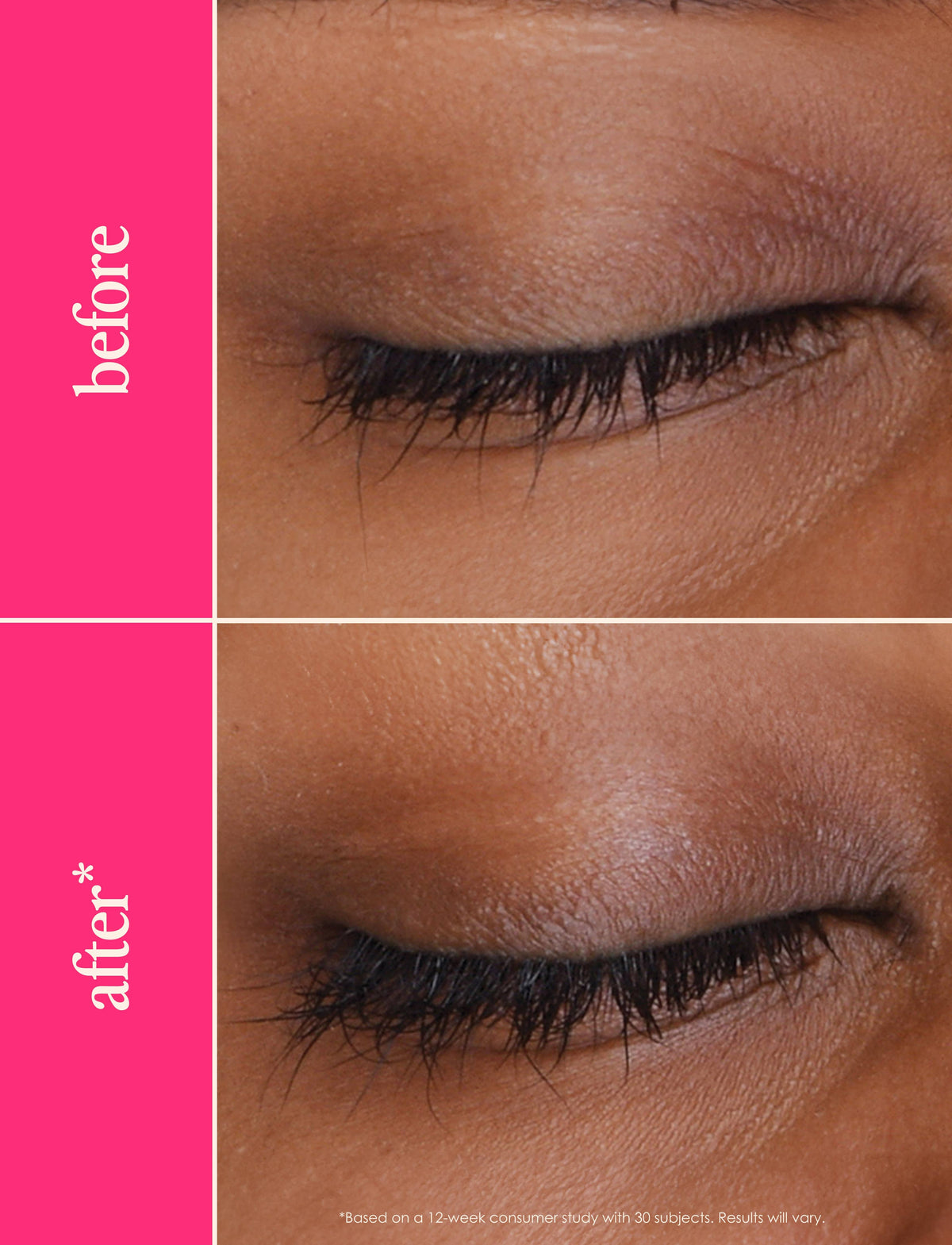 GrandeLASH-MD Lash Enhancing Serum: 1 mL (6 Week Supply)